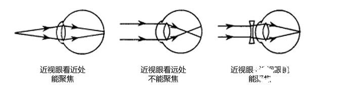 近视眼的兄弟们进了研究研究-眼镜能否变成可调度数的眼镜?图1