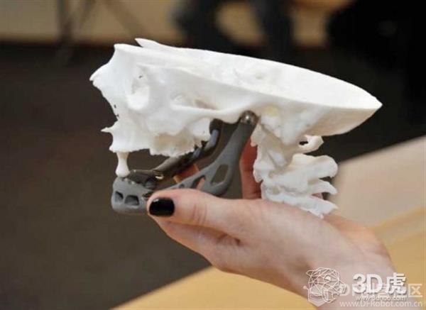 【研究预测】3D打印将成为医疗领域的主流应用图2