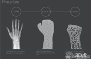 【研究预测】3D打印将成为医疗领域的主流应用图3