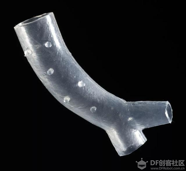 3D打印模具定制硅胶气管支架获美国FDA批准图1