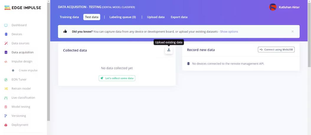 AI驱动的牙模分类器—基于Edge Impulse平台图46