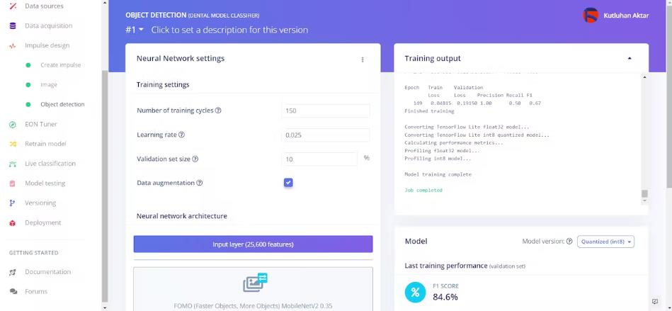 AI驱动的牙模分类器—基于Edge Impulse平台图54