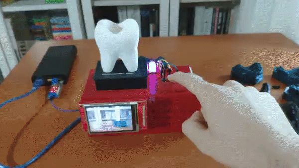 AI驱动的牙模分类器—基于Edge Impulse平台图65
