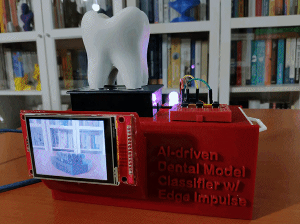 AI驱动的牙模分类器—基于Edge Impulse平台