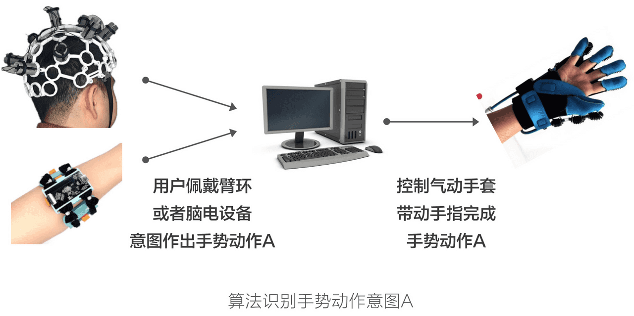 国产基于脑机接口的中风后主动康复训练解决方案图1