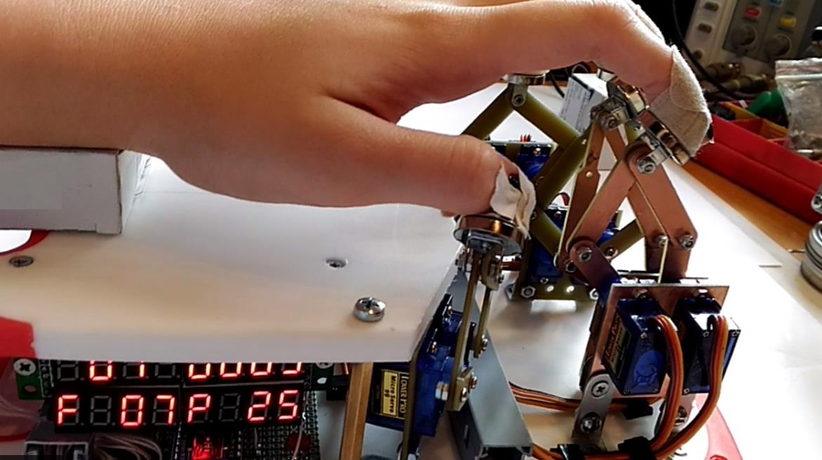 【Arduino 动手做】3D打印的10舵机中风后痉挛康复助手封面2
